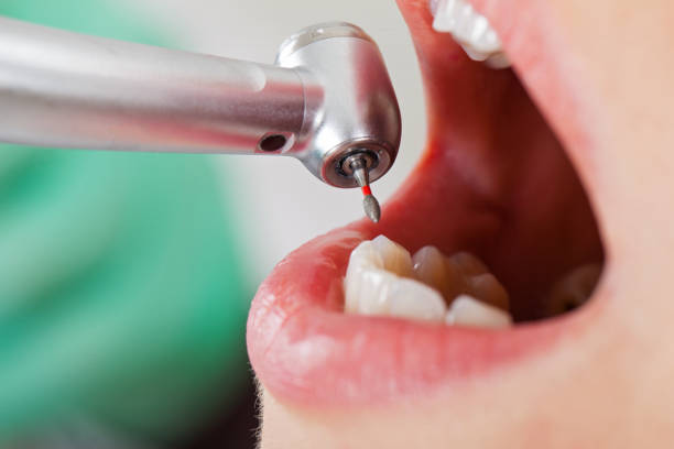 Best Knocked-Out Tooth Emergency  in Lonsdale, MN
